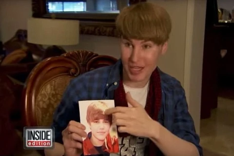 Tobias Strebel đã bỏ ra 100.000 USD để phẫu thuật cho giống thần tượng Justin Bieber. (Ảnh: Inside Edition)