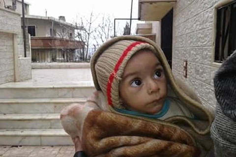 Một em bé bị suy dinh dưỡng nghiêm trọng do cuộc nội chiến ở Madaya, Syria. (Nguồn: theguardian.com)