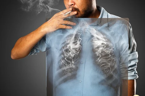 Quản lý thuốc lá thế hệ mới: Tránh kẽ hở gây tác động tiêu cực