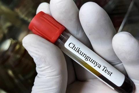 Mỹ phê duyệt vaccine đầu tiên trên thế giới ngừa virus Chikungunya