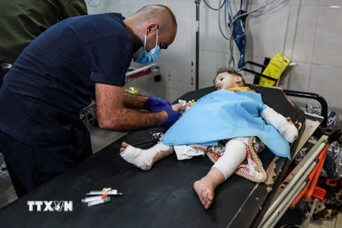 Điều trị cho em nhỏ bị thương trong xung đột Israel-Hamas tại bệnh viện Nasser ở Khan Yunis, phía Nam Dải Gaza, ngày 20/11/2023. (Ảnh: AFP/TTXVN)