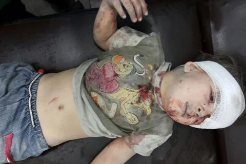 Báo chí Phương Tây đăng tải hình ảnh cậu bé Omran, 5 tuổi, được cứu khỏi tòa nhà đổ nát ở khu vực bị phong tỏa tại Aleppo. (Nguồn: Telegraph)