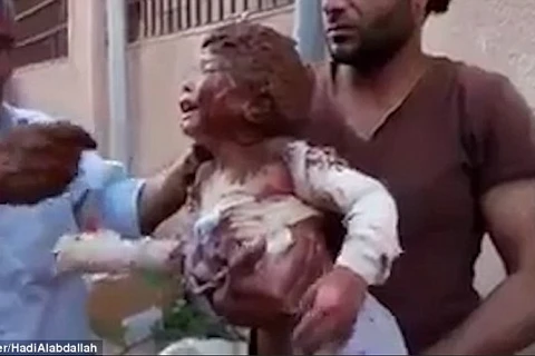 Bé gái Syria tội nghiệp. (Nguồn: Daily Mail)
