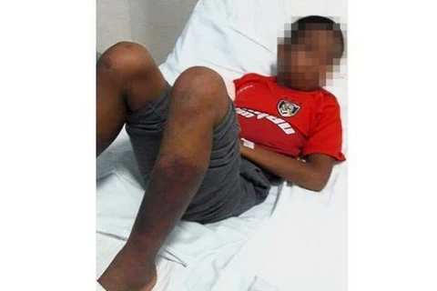 Học sinh Malaysia phải cắt bỏ hai chân do bị người giám sát tôn giáo tra tấn. (Ảnh: The Star)