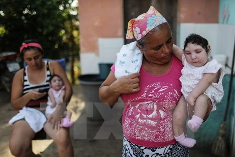 Cặp song sinh bị dị tật đầu nhỏ do mẹ bị nhiễm virus Zika tại Areia, bang Paraiba, Brazil. (Ảnh: AFP/TTXVN)