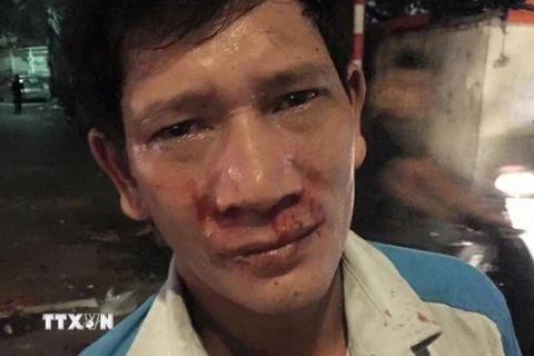 Anh Nguyễn Văn Sinh bị hành hung. (Ảnh Mạnh Khánh/TTXVN)