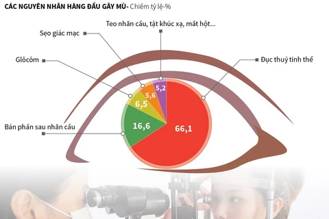 [Infographics] Kiểm soát các bệnh lý về mắt để tránh mù lòa
