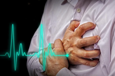 Phân tích hình ảnh chụp cắt lớp vi tính (CT) có thể giúp dự đoán những trường hợp có nguy cơ bị đau tim. (Nguồn: Medical News Today)