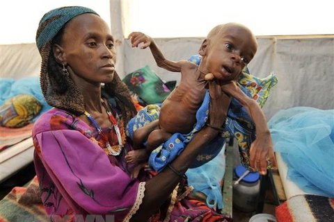 Trẻ em bị suy dinh dưỡng tại Tanout, Nam Niger. (Nguồn: AFP/TTXVN)