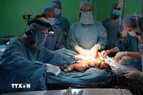 Bác sỹ Bệnh viện Nhi đồng 1 Thành phố Hồ Chí Minh phẫu thuật tách rời 2 bé gái song sinh dính bụng ngày 2/10. (Ảnh: TTXVN)