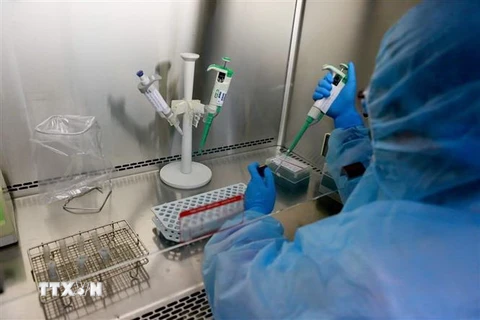 Xét nghiệm virus SARS-CoV-2 tại Bệnh viện Trung ương Huế. (Nguồn: TTXVN)