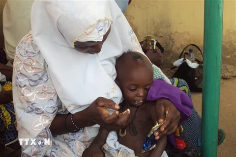 Trẻ em suy dinh dưỡng tại thành phố Gombe, Nigeria. (Ảnh: AFP/TTXVN)