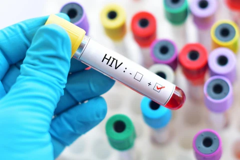 Xét nghiệm HIV. (Nguồn: myvuenews.com)