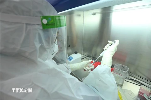 Thực hiện xét nghiệm khẳng định SARS-CoV-2 bằng phương pháp RT-PCR tại Yên Bái. (Nguồn: TTXVN)