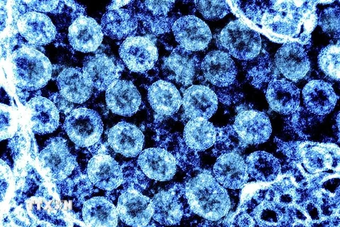 Phần tử virus SARS-CoV-2 trong mẫu bệnh phẩm của bệnh nhân mắc COVID-19. (Ảnh: AFP/TTXVN)