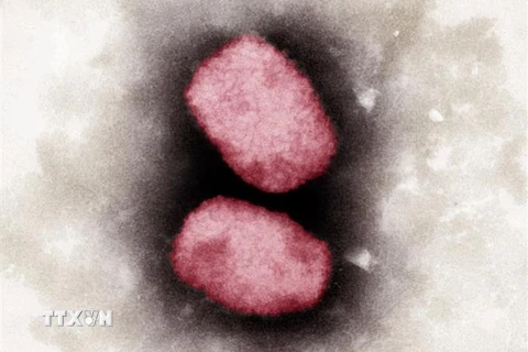 Virus đậu mùa khỉ nhìn dưới kính hiển vi. (Ảnh: AFP/TTXVN)