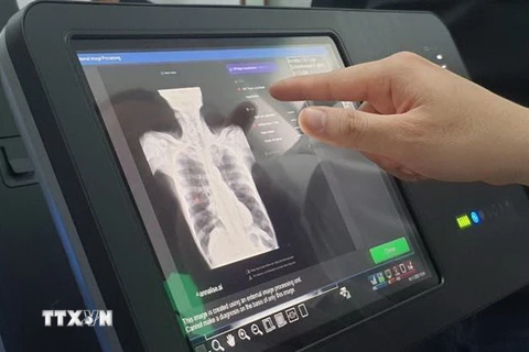 Máy chụp X-quang tích hợp trí tuệ nhân tạo được triển khai phục vụ người dân xã đảo Thạnh An, huyện Cần Giờ, Thành phố Hồ Chí Minh. (Ảnh: TTXVN phát)