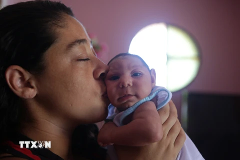 Một em bé bị teo não do nhiễm virus Zika tại Rio de Janeiro, Brazil. (Nguồn: THX/TTXVN)