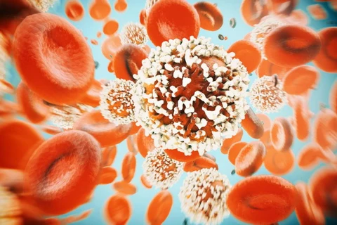 Tế bào ung thư. (Nguồn: medicalnewstoday.com)