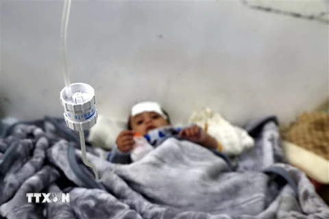 Trẻ em bị suy dinh dưỡng điều trị tại bệnh viện ở Sanaa, Yemen. (Ảnh: THX/TTXVN)