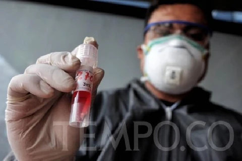 Kết quả một xét nghiệm PCR tại ga Bekasi, Tây Java, ngày 5/5.(Nguồn: tempo.co)