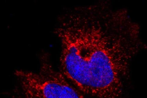 Phát hiện phân tử protein làm thay đổi cấu trúc tế bào ung thư vú
