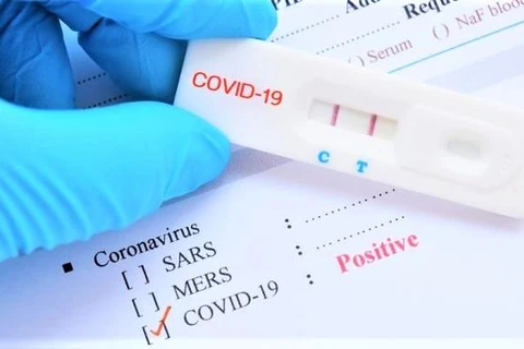 Rà soát việc dân tự phát hiện mắc COVID-19 nhưng không thông báo