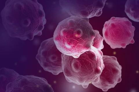 Sanofi ngừng phát triển chất amcenestrant điều trị ung thư vú