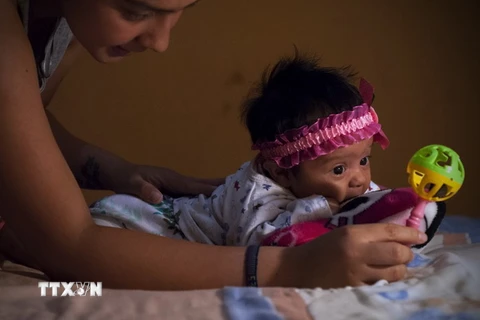 Em bé bị mắc chứng đầu nhỏ tại thủ đô Quito, Ecuador. (Nguồn: THX/TTXVN) 
