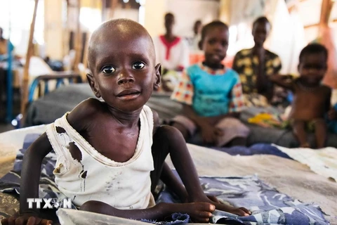 Trẻ em Sudan bị suy dinh dưỡng điều trị tại một bệnh viện ở Aweil. (Nguồn: AFP/TTXVN) 