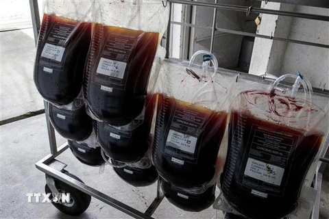 Huyết thanh ngựa được sử dụng để điều trị bệnh nhân COVID-19 (Ảnh: AFP/ TTXVN)