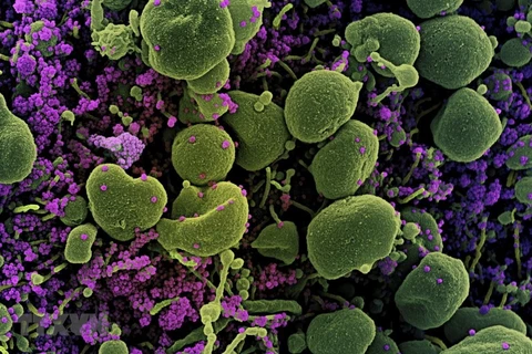 Hình ảnh quét qua kính hiển vi điện tử cho thấy tế bào (màu xanh) bị virus SARS-COV-2 (màu tím) xâm nhập. (Ảnh: AFP/TTXVN) 
