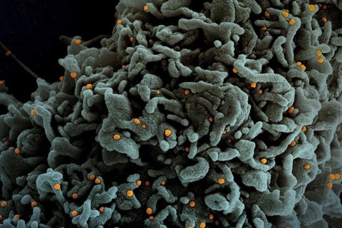 Hình ảnh quét qua kính hiển vi điện tử cho thấy tế bào (màu xanh) bị virus SARS-COV-2 (màu cam) xâm nhập, lấy từ mẫu bệnh phẩm của bệnh nhân COVID-19 tại Viện Nghiên cứu Dị ứng và Bệnh Truyền nhiễm Quốc gia, Mỹ ngày 31/3/2021. (Ảnh: AFP/TTXVN)
