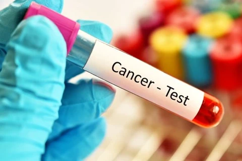 Australia đạt được bước đột phá trong việc sàng lọc ung thư ruột 
