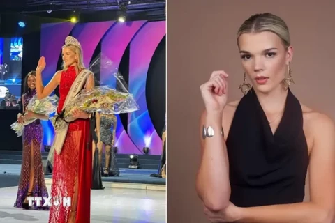 Người đẹp da trắng gây tranh cãi khi trở thành Hoa hậu Zimbabwe