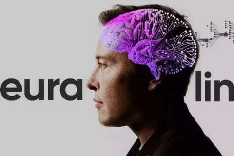 Neuralink, công ty sản xuất chip não của tỷ phú Elon Musk. (Nguồn: Neuralink)