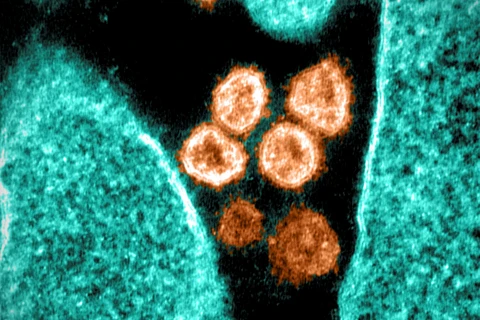 Hình ảnh virus SARS-CoV-2 chụp qua kính hiển vi điện tử tại phòng thí nghiệm ở Hamilton, Montana (Mỹ), ngày 28/6/2021. (Ảnh: AFP/TTXVN)