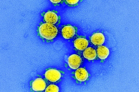 Hình ảnh virus SARS-COV-2 trên một mẫu bệnh phẩm của bệnh nhân COVID-19 qua kính hiển vi điện tử, ở Maryland (Mỹ). (Ảnh: AFP/TXVN)