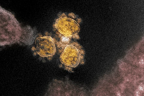 Hình ảnh qua kính hiển vi điện tử cho thấy virus SARS-CoV-2 trên một mẫu bệnh phẩm của bệnh nhân COVID-19, tại Viện Nghiên cứu Dị ứng và Bệnh Truyền nhiễm Quốc gia (Mỹ). (Ảnh: AFP/TTXVN)