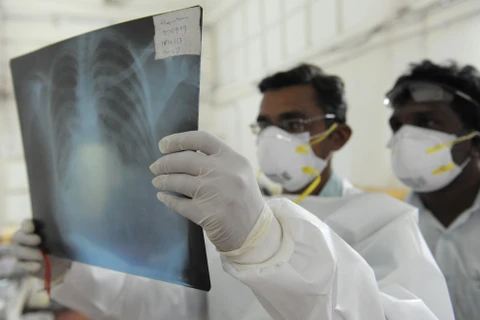 Kiểm tra phim chụp X-quang bệnh nhân nhiễm virus H1N1 tại bệnh viện ở Ahmedabad, Ấn Độ ngày 12/3/2013. Ảnh minh họa. (Nguồn: AFP/TTXVN)