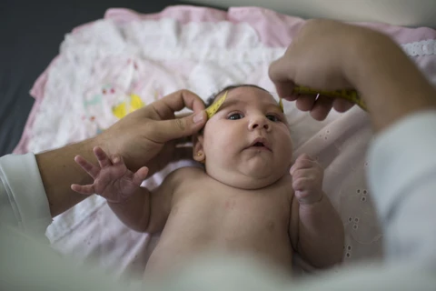 Đo vòng đầu cho trẻ sơ sinh ở Brazil, quốc gia đang bị virus Zika hoành hành. (Nguồn: AP)
