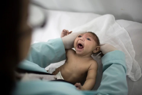 Một trẻ sơ sinh bị chứng đầu nhỏ do nhiễm virus Zika. (Nguồn: AP)