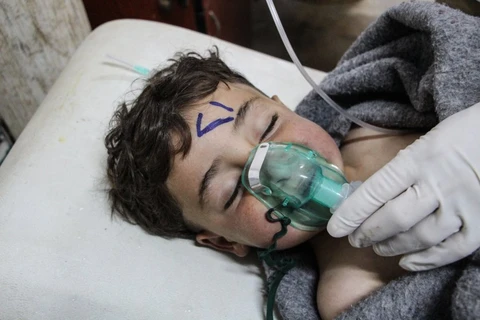 Một em nhỏ đang được cấp cứu tại bệnh viên sau vụ tấn công ở Idlib, ngày 4/4. (Nguồn: EPA)
