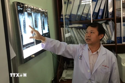 Bác sỹ bệnh viện Chợ Rẫy đang phân tích phim chụp của bệnh nhân. (Ảnh: Đinh Hằng/TTXVN)