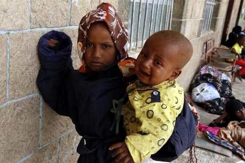 Trẻ em Yemen đang phải chịu cảnh khốn cùng. (Nguồn: EPA)