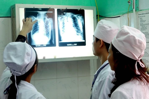 10% người Việt bị phổi tắc nghẽn mạn tính, hen phế quản
