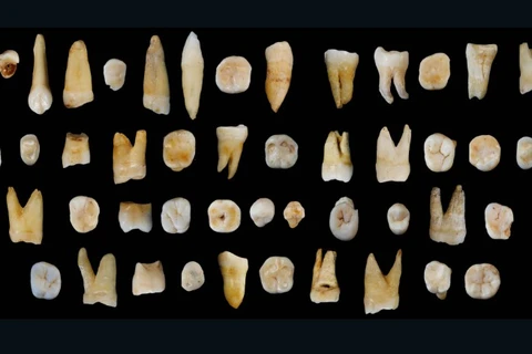 Những chiếc răng khai quật được. (Nguồn: cnn.com)