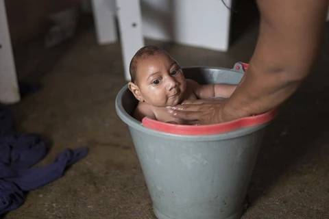 Virus Zika gây ra chứng bệnh đầu nhỏ ở trẻ sơ sinh. (Nguồn: AP)