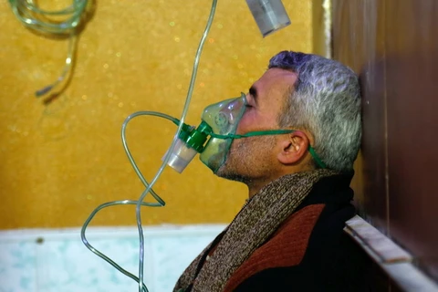 Một nạn nhân trong vụ tấn công, được cho là sử dụng vũ khí hóa học, được điều trị tại một bệnh viện ở Douma, Đông Ghouta, Syria ngày 22/1. (Nguồn: AFP/TTXVN)