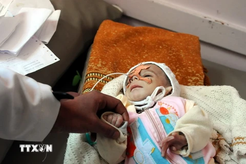 Điều trị cho trẻ em bị suy dinh dưỡng tại bệnh viện ở Sanaa, Yemen ngày 15/1. (Nguồn: THX/TTXVN)